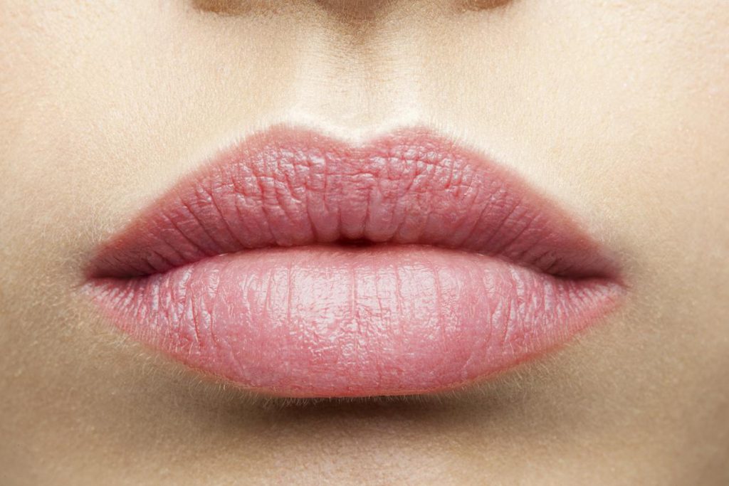 Miten ja millä korjata rohtuneet huulet? Kotiohjeet & reseptit